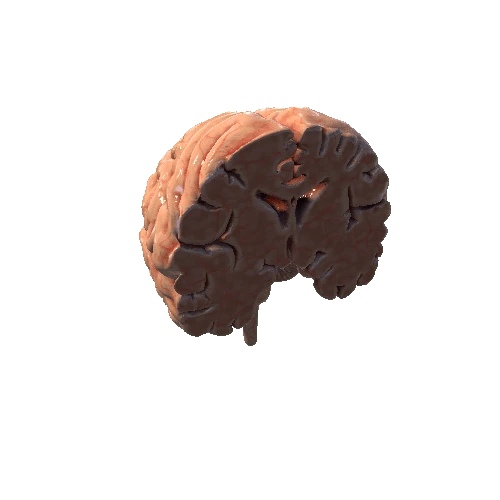 HumanBrainCross_Frontal Plane